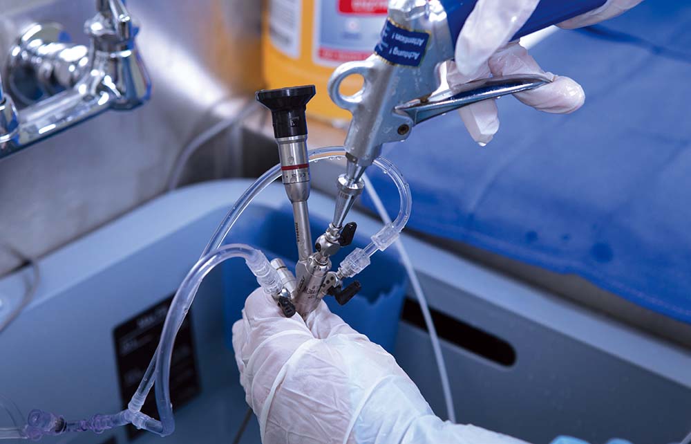 The Role of Endoscopy Equipment in Accurate Diagnosis
